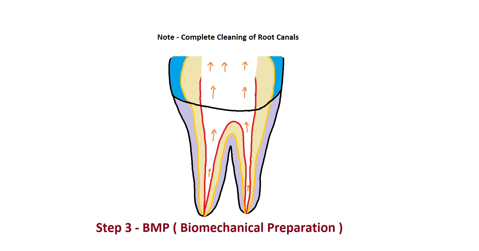 Why Dental Caries ? know simple answers.